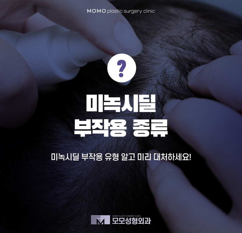 미녹시딜부작용 미리 알고 올바르게 관련 이미지 1