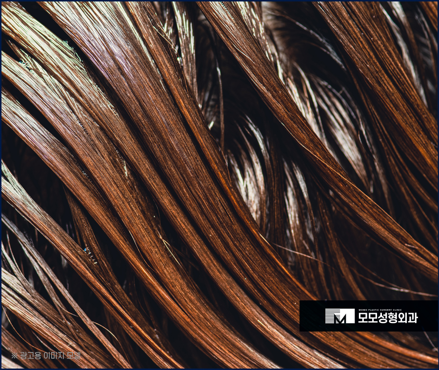 머리안감으면탈모 증상이 찾아올까요 진실은 관련 이미지 4