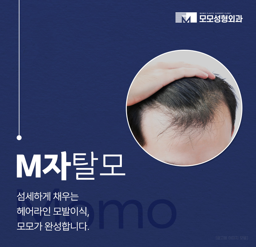 엠자 탈모 섬세하게 채워 만드는 변화 관련 이미지 1