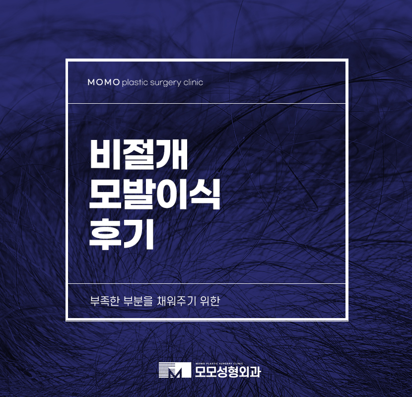 비절개모발이식후기 부족한 부분을 고민하여 관련 이미지 1