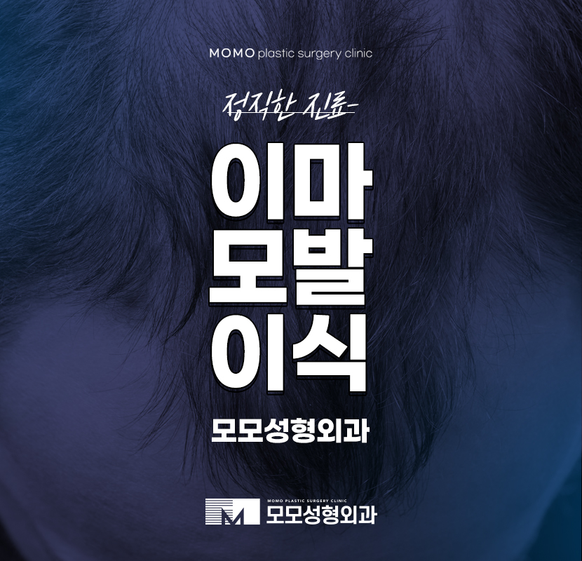 이마모발이식 망설이는 시간에 움직여 관련 이미지 1