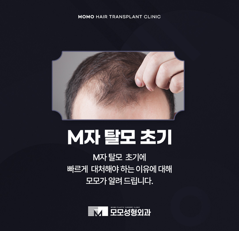 m자탈모초기 빠른 대처를 이뤄낸다면 관련 이미지 1