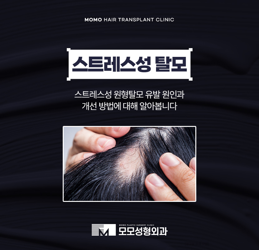 스트레스성 원형탈모를 유발하는 원인은 관련 이미지 1