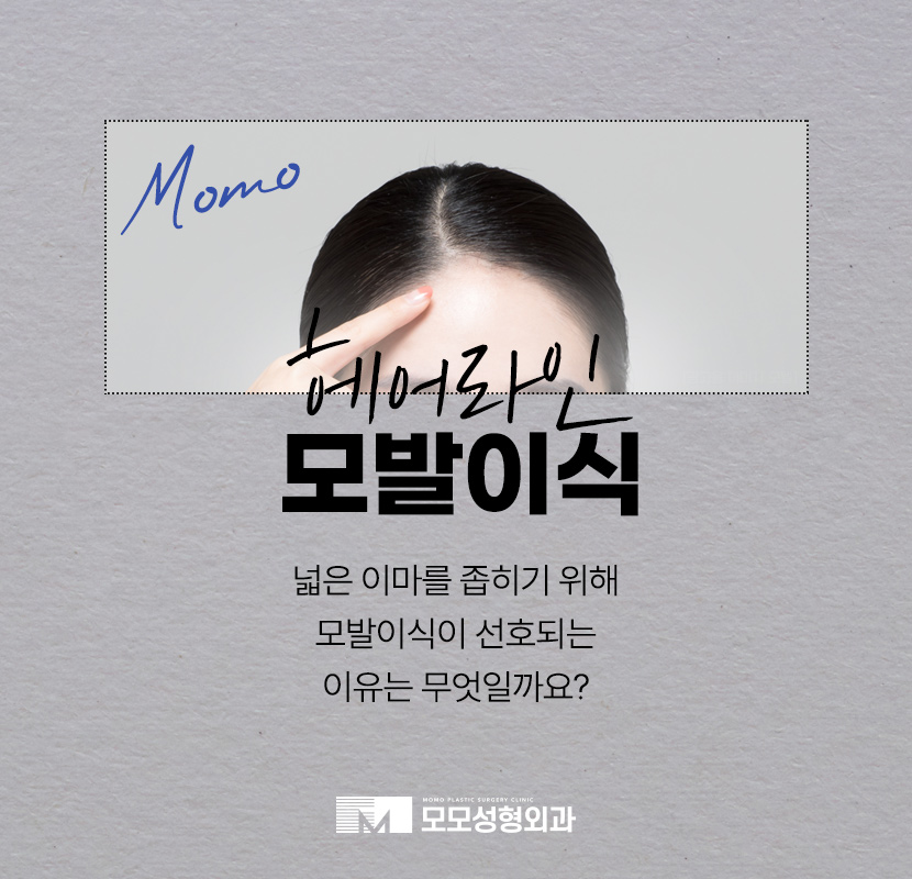 이마 축소술 비용 및 모발이식이 선호되는 이유 관련 이미지 1