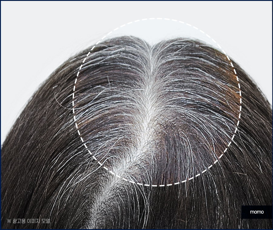 염색후 두피 가려움 원인과 완화 방법 관련 이미지 3