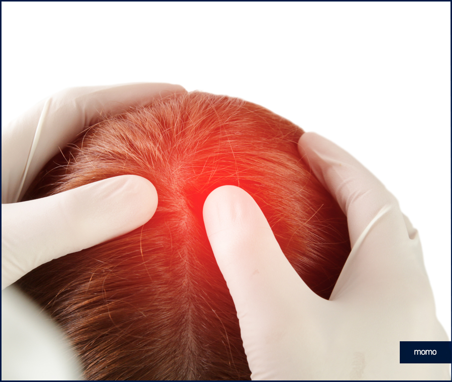 두피 누르면 통증이 느껴질 경우 위험한 이유 관련 이미지 6