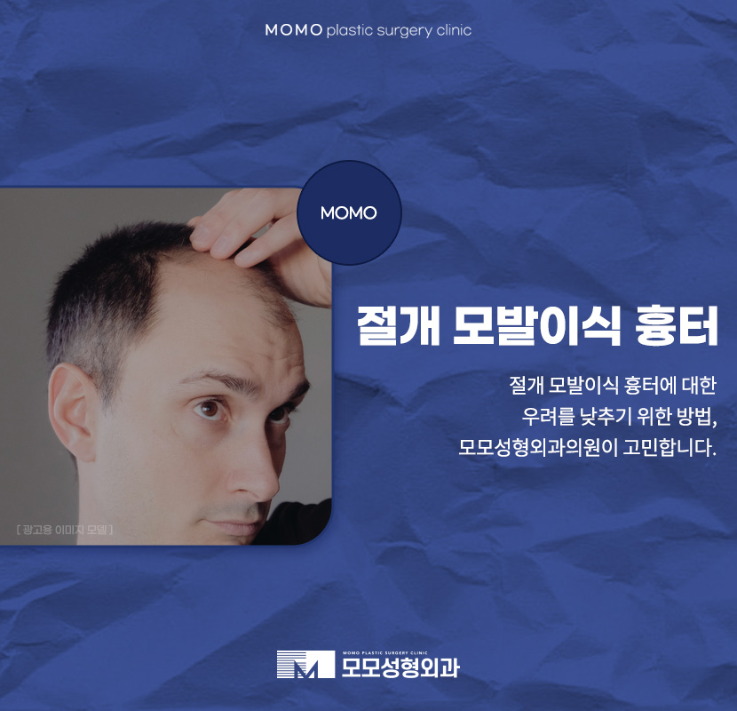 절개모발이식흉터 정도와 흔적이 싫은 상황이라면 관련 이미지 1