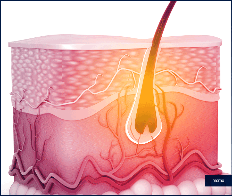 비절개 모발이식 후기와 함께 꼭 알아볼 이것! 관련 이미지 2