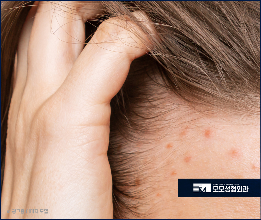 머리안말리고자면 어떤 문제들이 생겨날까 관련 이미지 5