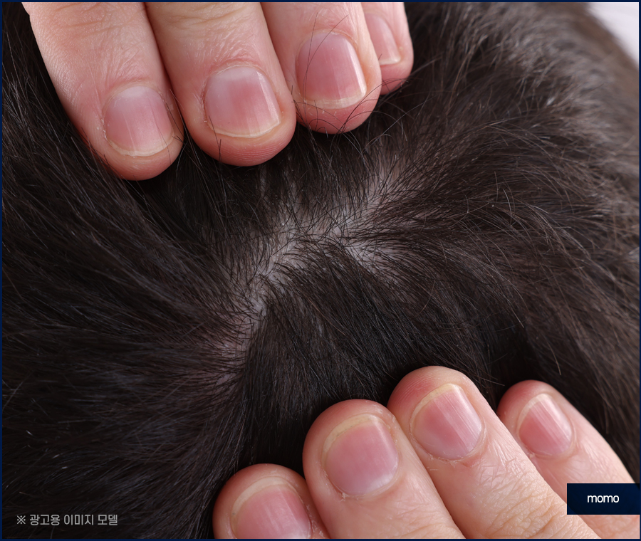 정수리 냄새 제거 원인부터 탁월한 제거 방안까지 관련 이미지 3