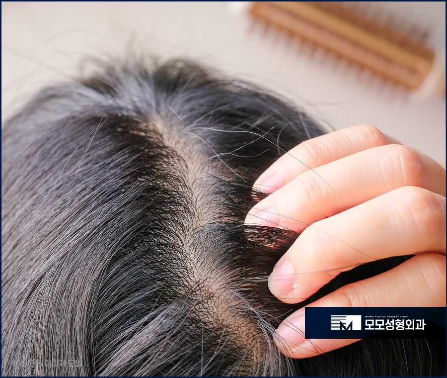 린스와트리트먼트차이와 올바른 사용 방법에 관해 관련 이미지 2