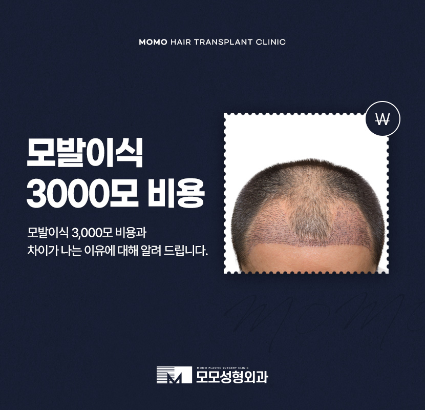 모발이식3000모비용 차이나는 이유 관련 이미지 1