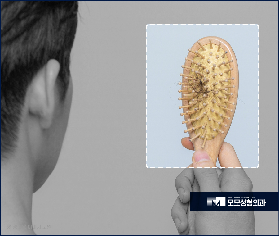 모발 얇아짐 이유와 두께를 복구하는 방법 관련 이미지 8