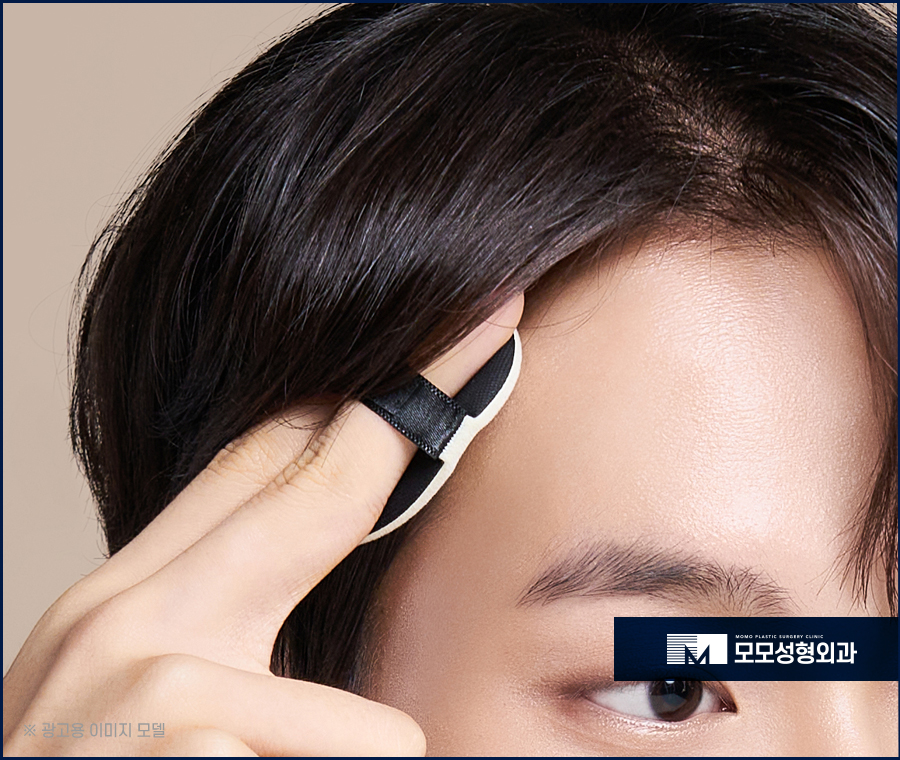 m자형 탈모 보완 시 꼭 짚어야 할 체크 포인트 (ft. 모발이식) 관련 이미지 5