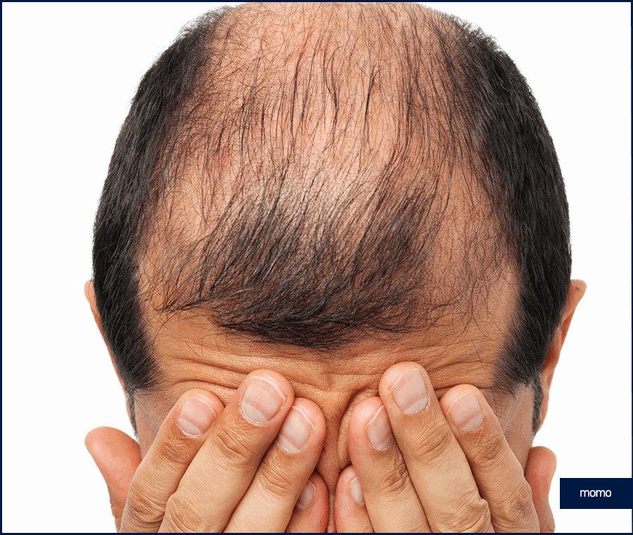 탈모약 처방 병원 꼼꼼한 진단하는 곳을 찾는다면 관련 이미지 5