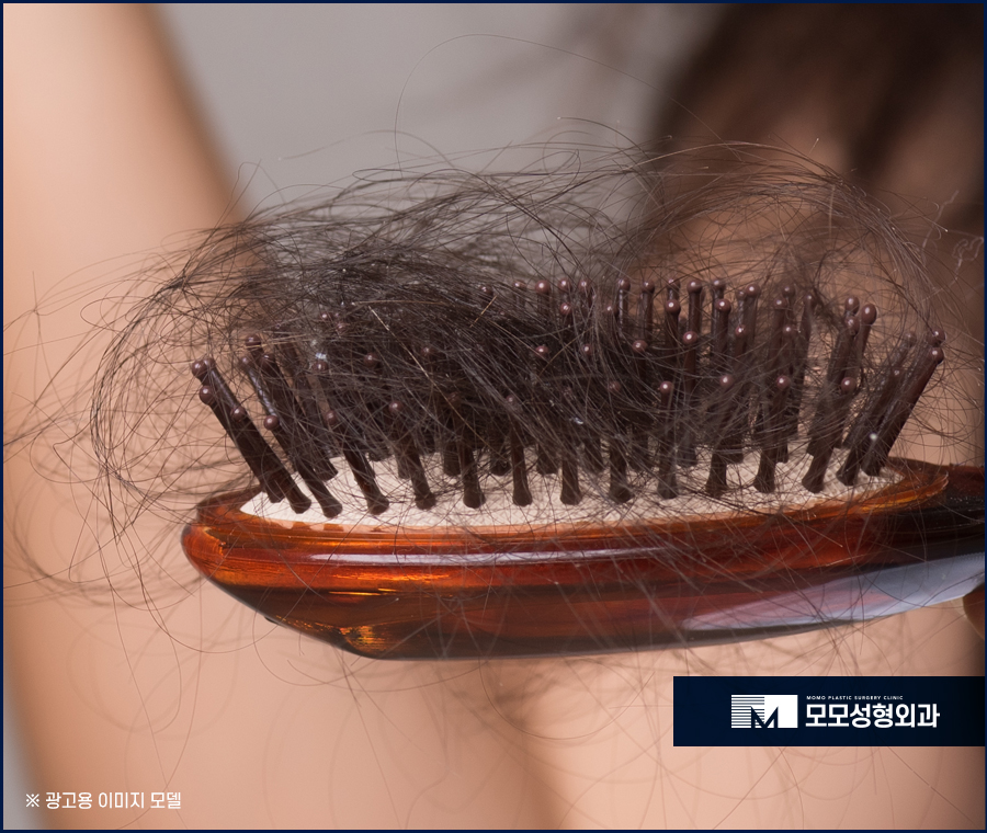 강남탈모치료 원인부터 알고 조치하도록 관련 이미지 3