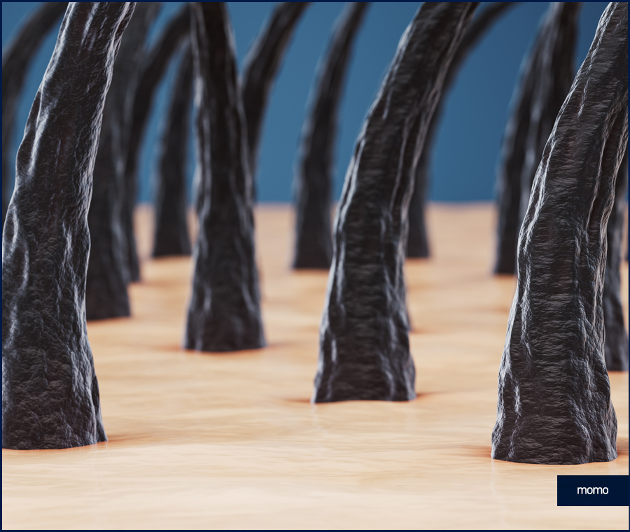 돼지털 머리카락 원인 및 완화하는 방법 3가지 관련 이미지 2