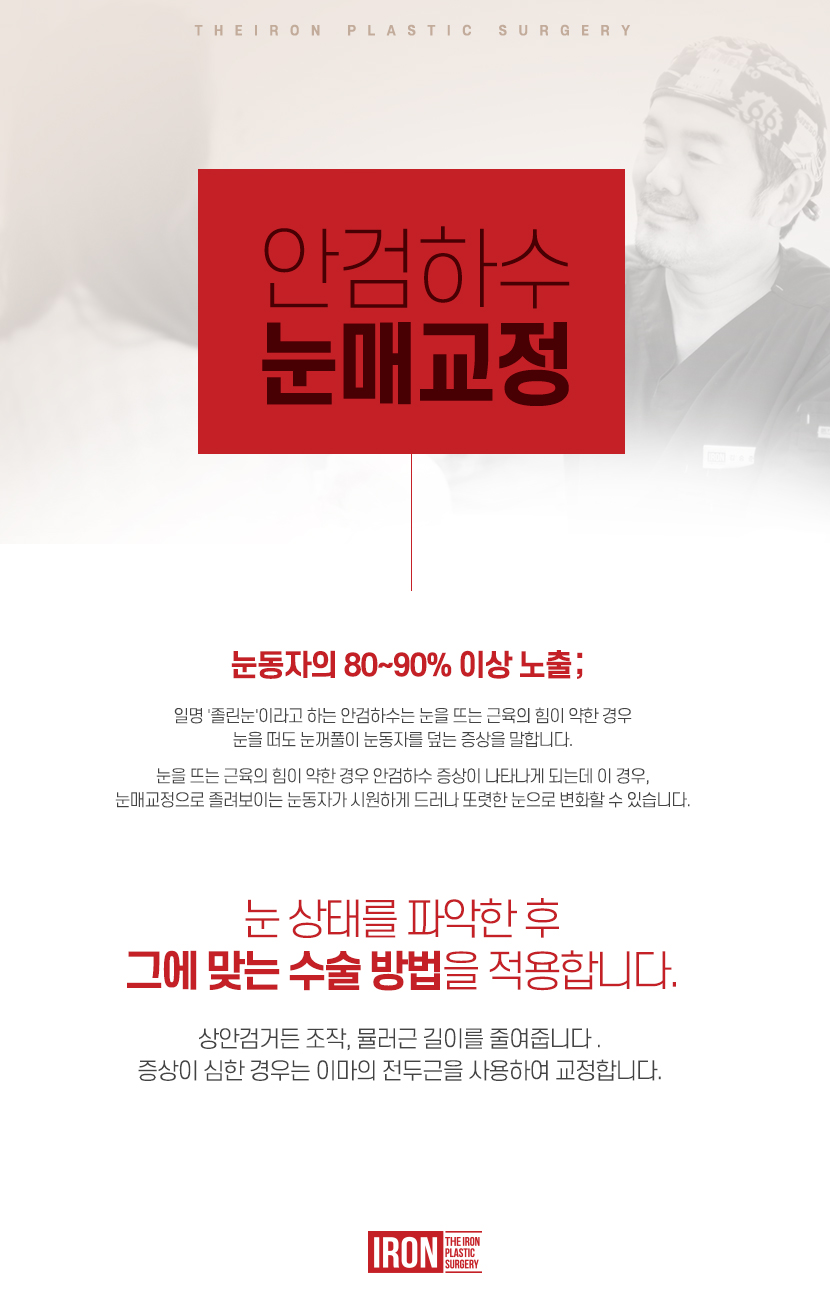 남자눈매교정 멋과 세련됨을 동시에 관련 이미지 6