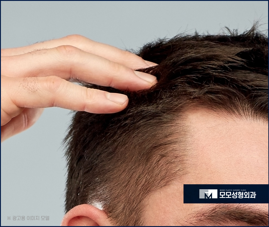 남자 옆머리 탈모 구레나룻의 양이 부족하다고 느껴질 경우엔 관련 이미지 5