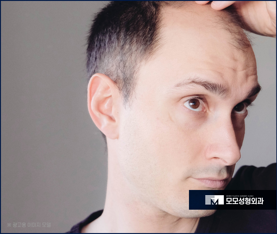 남자 옆머리 탈모 구레나룻의 양이 부족하다고 느껴질 경우엔 관련 이미지 6