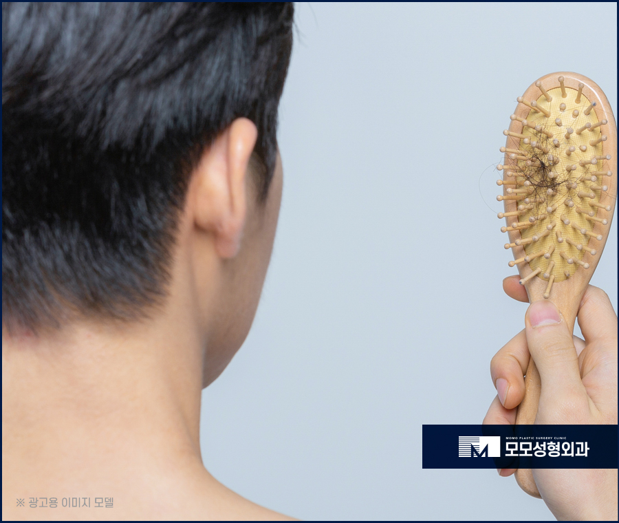 20대 모발이식 젊은 날의 외모 자신감을 위한 관련 이미지 3