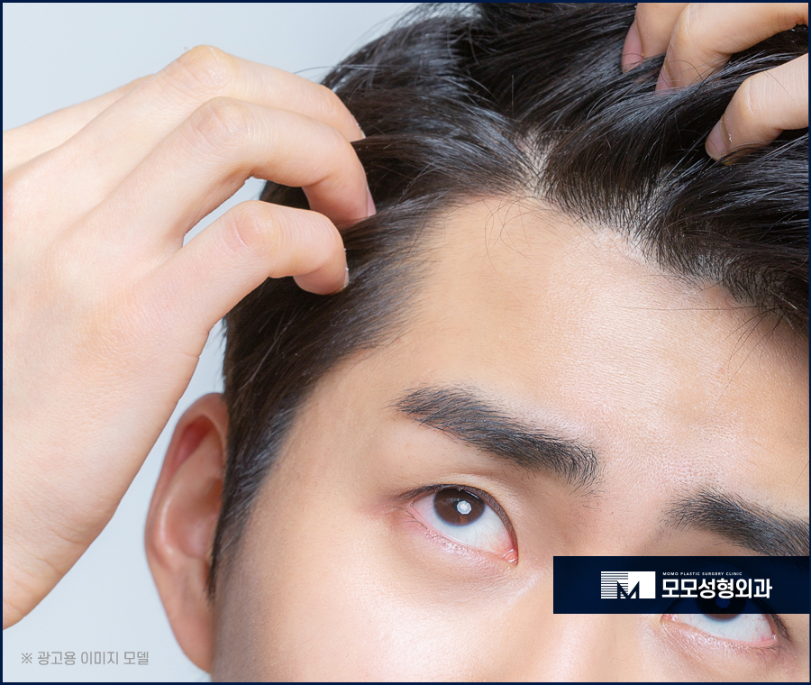 M자모발이식비용이 달라지는 기준과 방식의 차이에 대해 관련 이미지 2