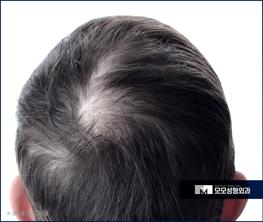 검은콩흰머리 효능에 대해 궁금하다면 관련 이미지 3