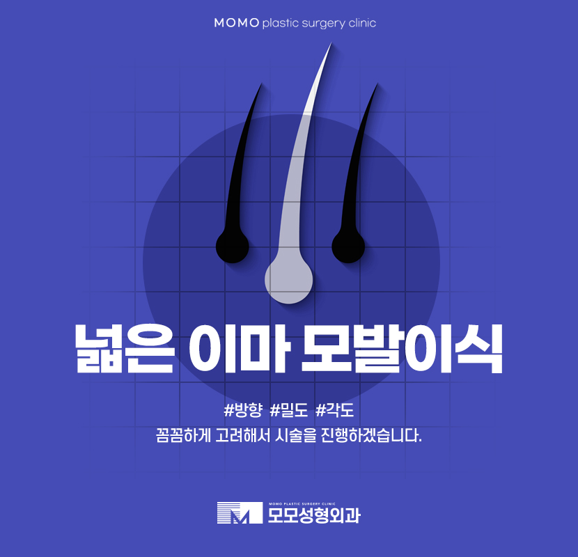 넓은이마모발이식 방향과 밀도까지 고려해 관련 이미지 1
