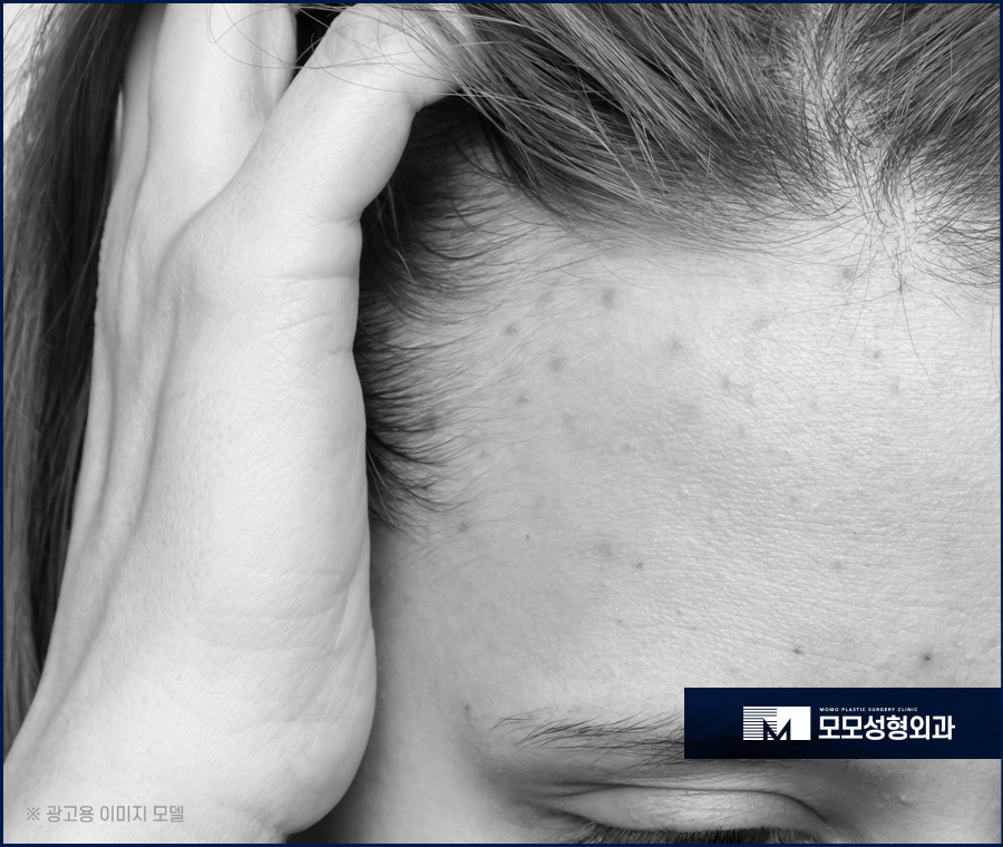 40대여자앞머리탈모 보강이 필요한 이유에 대해 관련 이미지 3