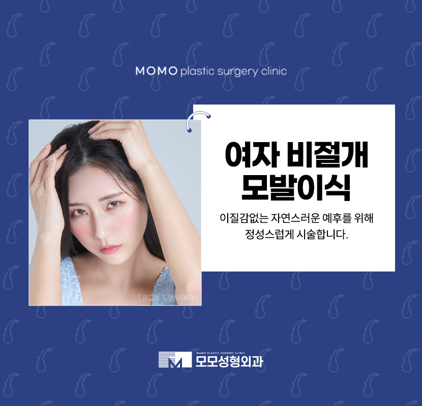 여자비절개모발이식 이질감없는 자연스러움으로 관련 이미지 1