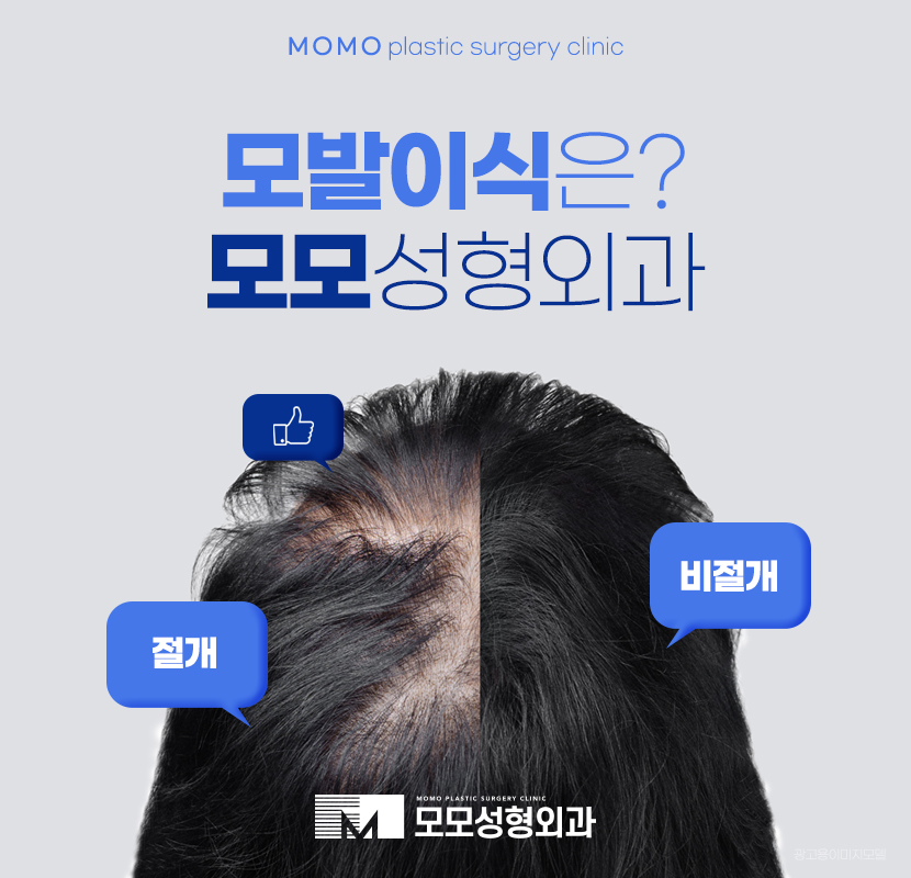모발이식잘하는곳 누가 봐도 자연스러운 관련 이미지 1