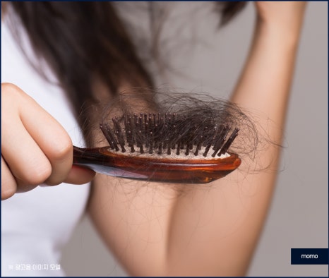 압구정 모발이식 탈모 문제를 해소하는 관련 이미지 2