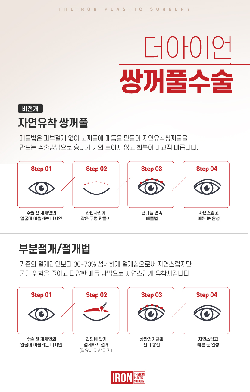 자연유착재수술 걱정 없이 변화됨을 관련 이미지 5