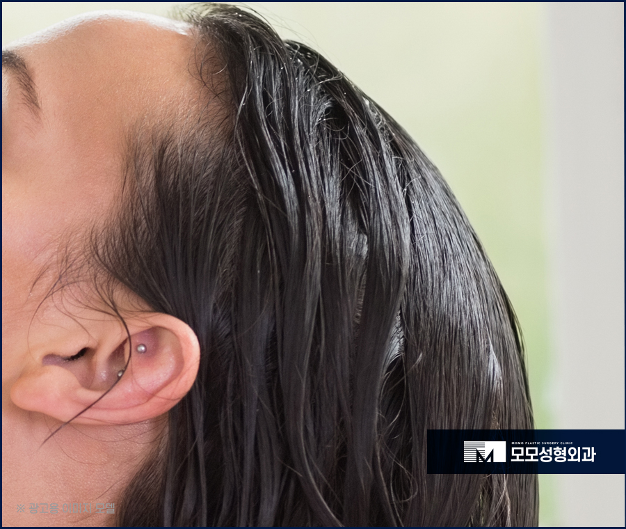 머리안감으면탈모 증상이 찾아올까요 진실은 관련 이미지 3