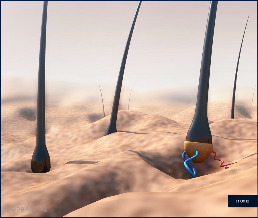 여자m자탈모 헤어라인 디자인까지 고려해 채우는 관련 이미지 7