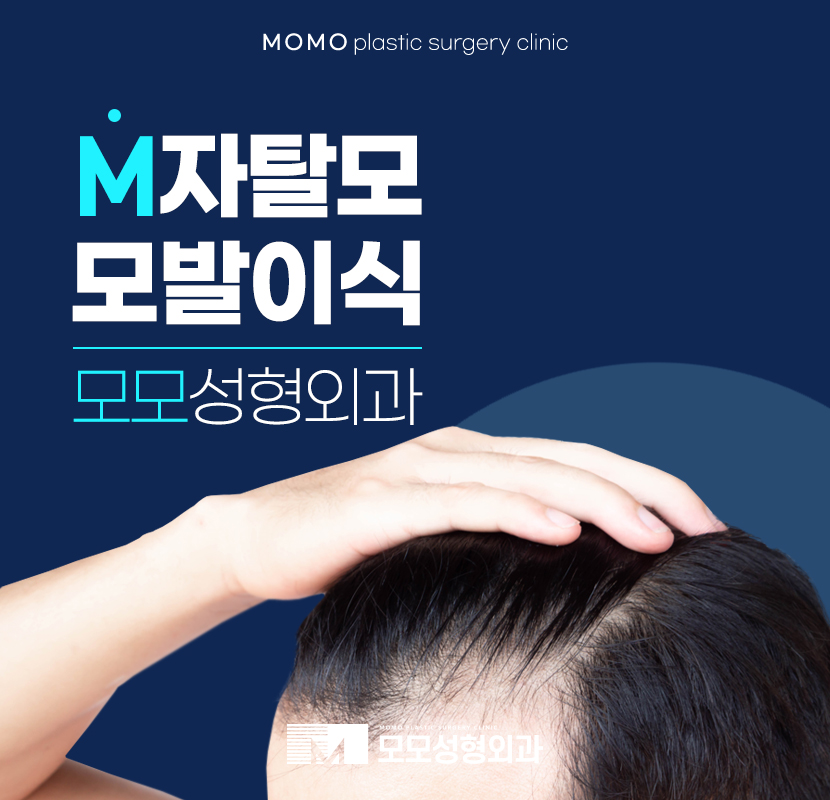 M자탈모 모발이식 개개인의 조건을 분석해서 관련 이미지 1