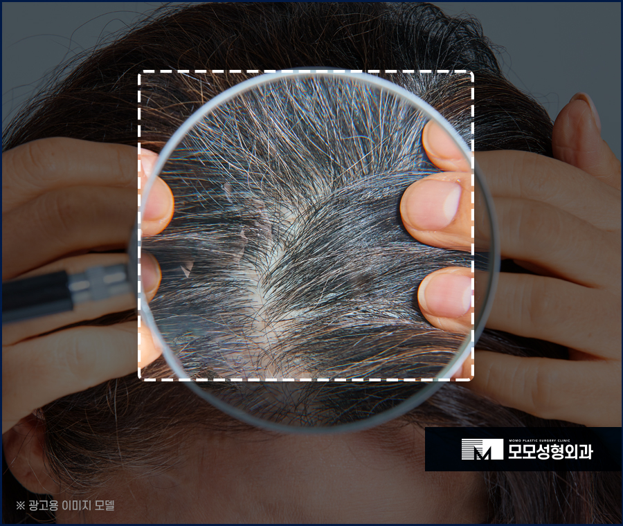 흰머리 간지러움 발생 요인부터 극복을 위해서는 관련 이미지 3