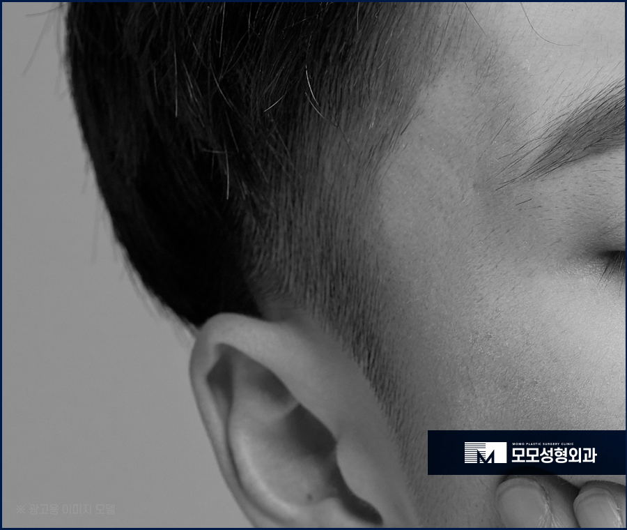 구렛나루 탈모 퍼스널 디자인으로 자연스럽게 관련 이미지 2