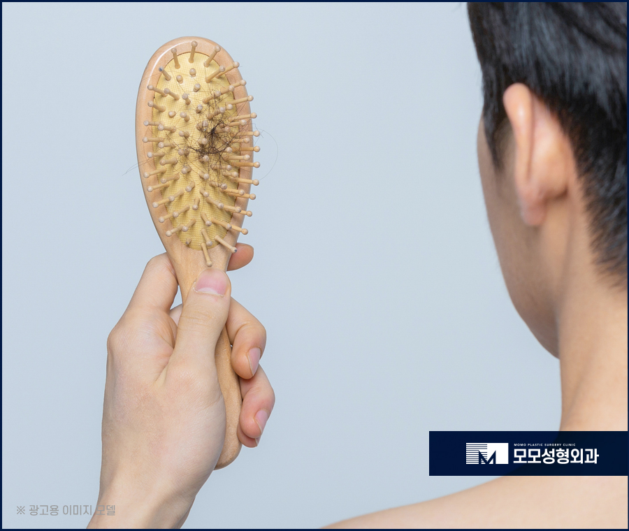 남자엠자탈모 극복을 위한 방향을 잘 잡아야만 관련 이미지 2