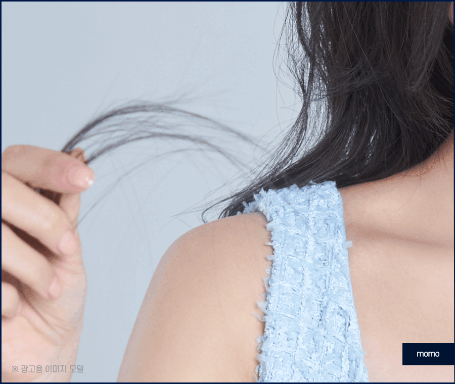 여자M자탈모 회복을 위한 맞춤 솔루션 관련 이미지 10