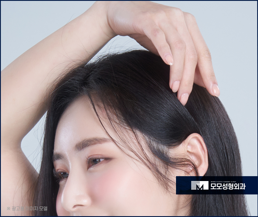 여성헤어라인모발이식 다양한 스타일링을 위해 관련 이미지 3