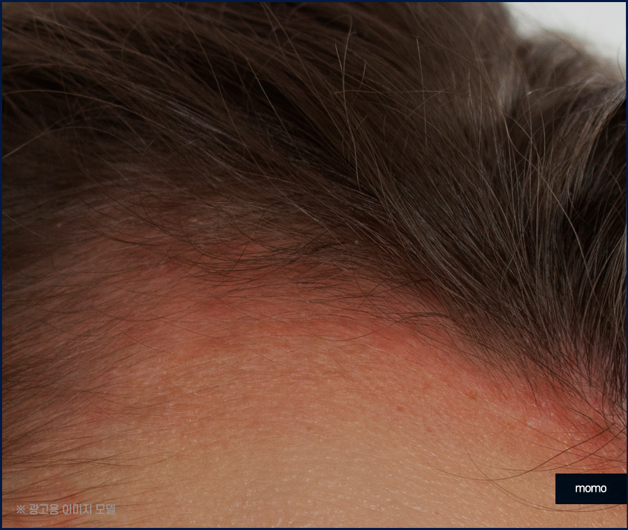 정수리 냄새 원인과 제거하기 위한 방법은 관련 이미지 7