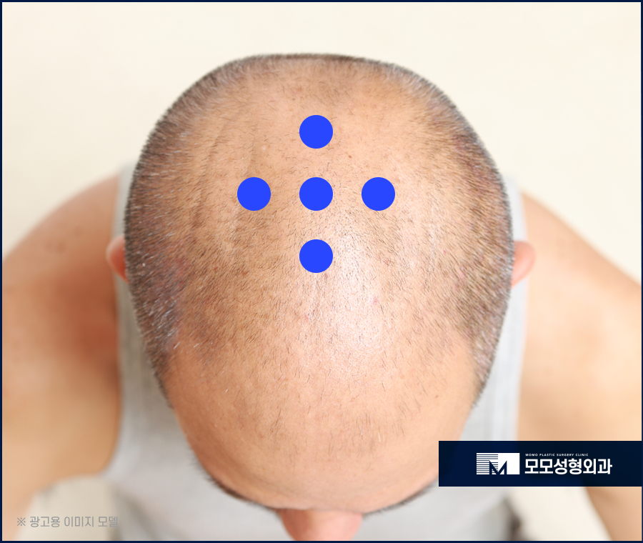 두피마사지법 증세에 효과적인 관련 이미지 6