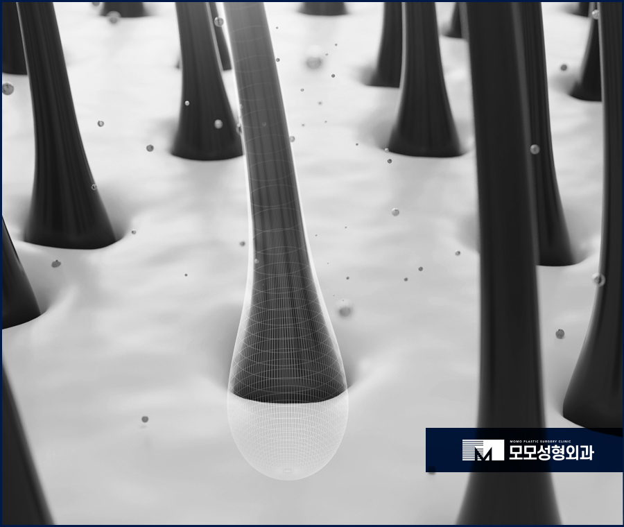 연모화 증상 원인과 방치에 대한 위험성까지 관련 이미지 4