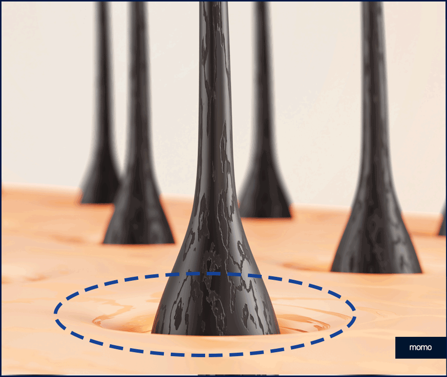 남자 탈모약으로 치료할 때 확인할 사항 관련 이미지 7