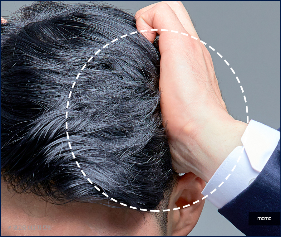 압구정 모발이식 건강한 두피를 만드는 방법 관련 이미지 3