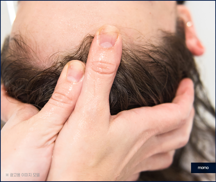 머리 비듬 생기는 이유부터 제거하는 효과적인 방법 관련 이미지 9