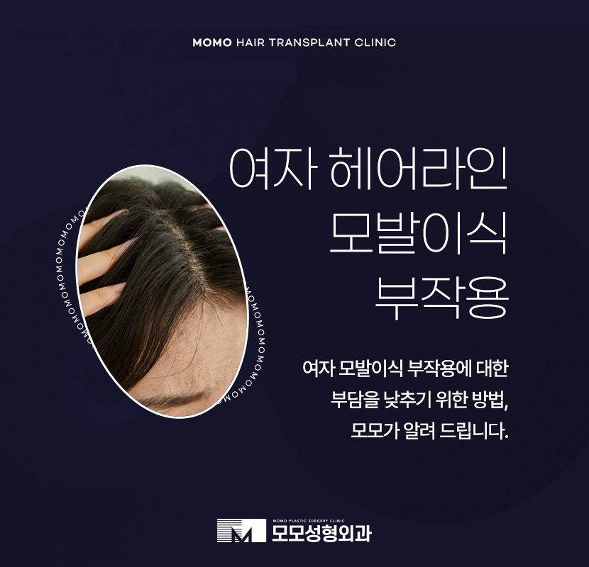 여자 헤어라인 모발이식 부작용 발생 우려를 낮춰야만 관련 이미지 1