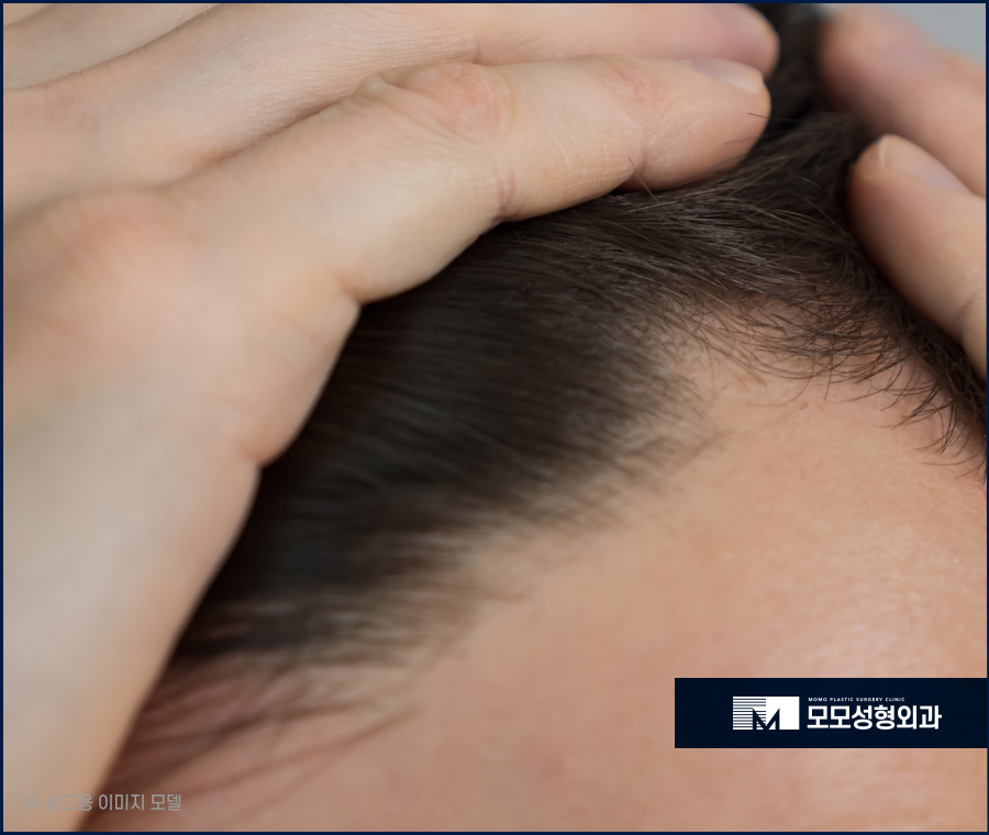 여자넓은이마 고민으로 부터 벗어나는 관련 이미지 3