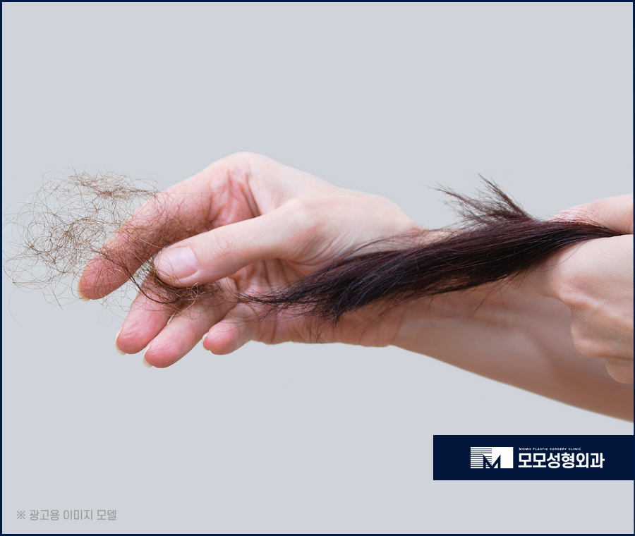 원형탈모 초기 타이밍을 놓치지 말고 대응해야 하는 이유 관련 이미지 8